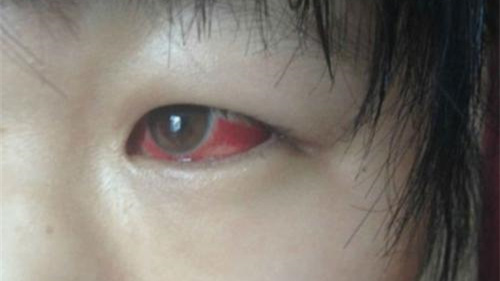 光觸媒除甲醛保護(hù)新裝修教室空氣，更保護(hù)孩子們