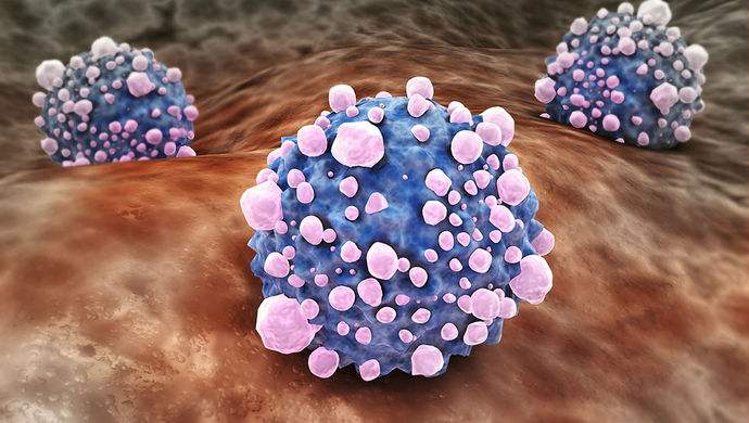 平時(shí)不注意甲醛超標(biāo)，50歲女子劇烈頭痛、惡心干嘔，一查已是癌癥晚期！